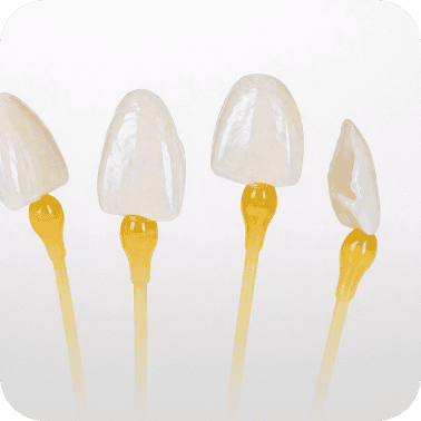 Porcelain dental veneers on yellow sticks for cosmetic dentistry.