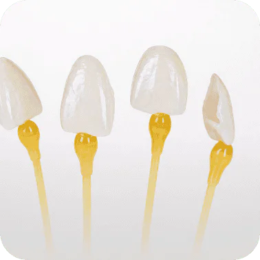 Porcelain dental veneers on yellow sticks for cosmetic dentistry.