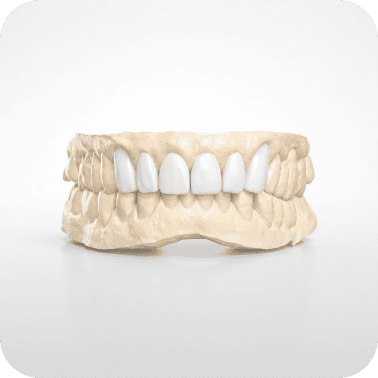 A dental model showcasing a full set of upper and lower teeth for dental restoration or orthodontic.