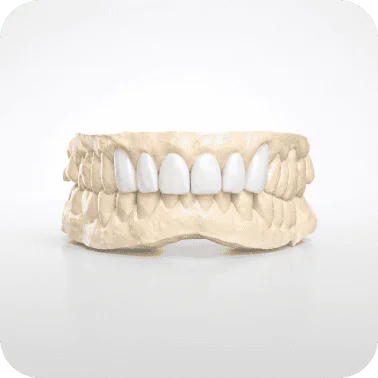 A dental model showcasing a full set of upper and lower teeth for dental restoration or orthodontic.