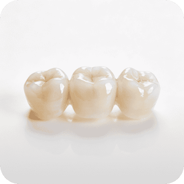 Porcelain dental crowns for restorative dentistry and dental prosthetics.
