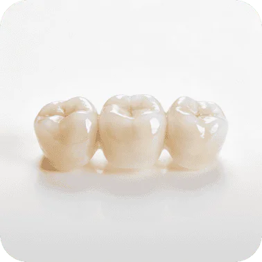 Porcelain dental crowns for restorative dentistry and dental prosthetics.