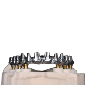 Zirconia Crown + Ti Thimble (12 units)