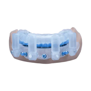 Stackable Guide Co-Cr Package